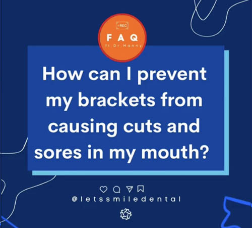 How can I prevent my brackets from causing cuts and sores in my mouth?