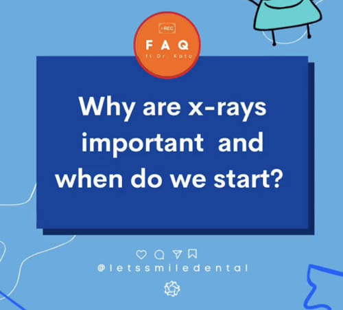 Why are x-rays important and when do we start