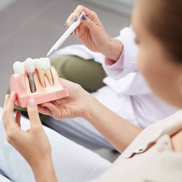 High angle view of unrecognizable young woman holding tooth model during consultation in dentists office, copy space